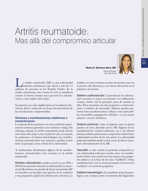 Artritis reumatoide 
