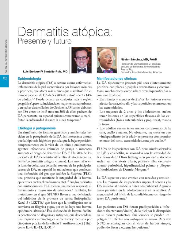 Dermatitis atópica 